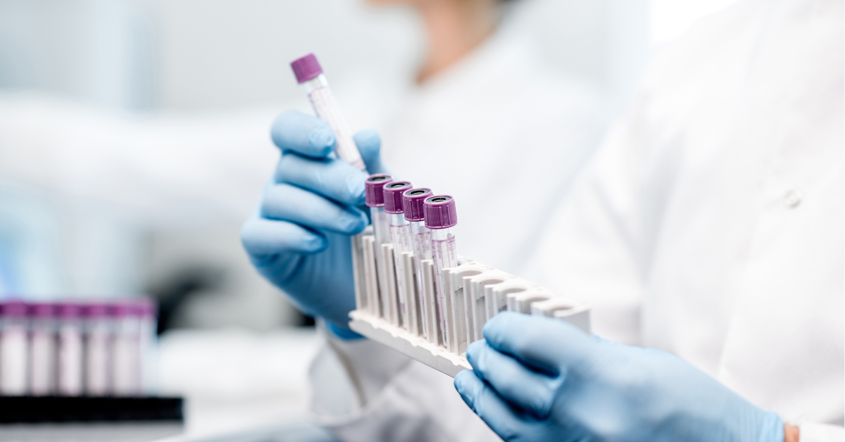 Pharma Companies Should Know About Territory Alignment