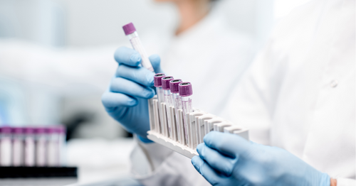 Pharma Companies Should Know About Territory Alignment